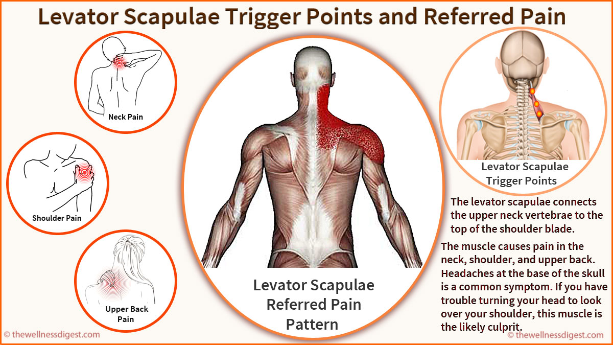 Levator Scapulae Muscle Neck Shoulder Headache Pain The Wellness