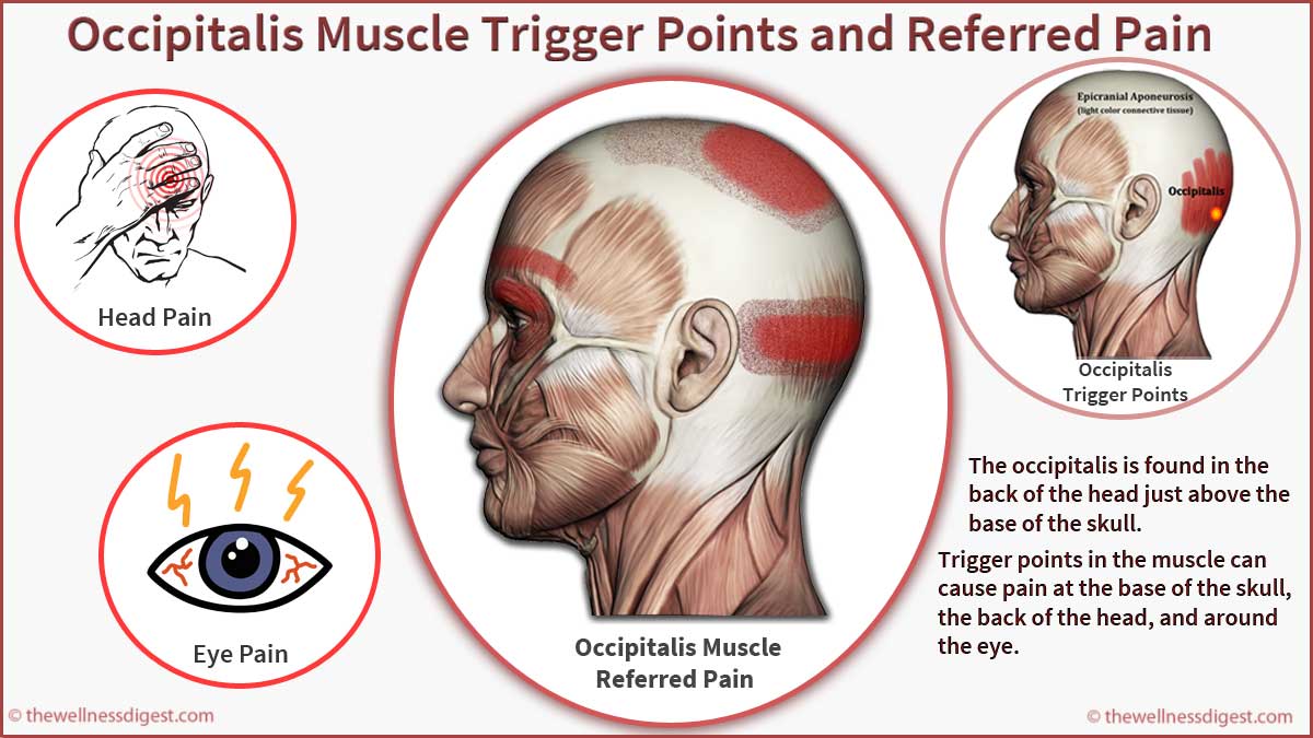 Occipitalis Muscle Headaches Head Eye Teeth Pain The Wellness Digest