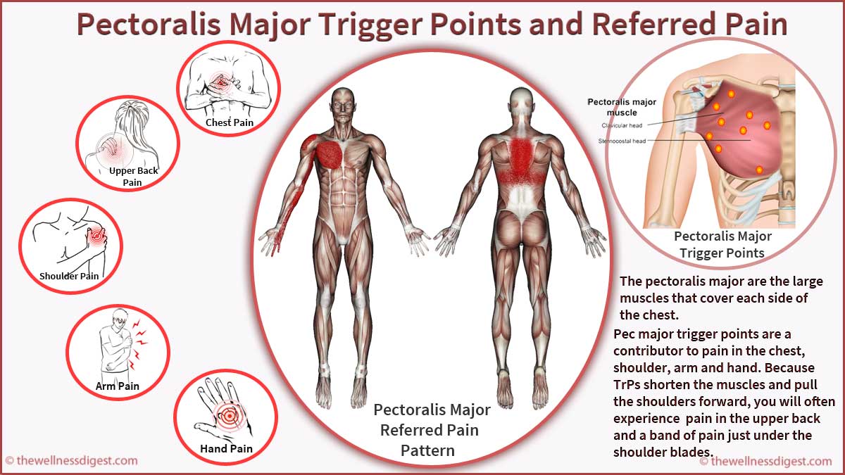 Pectoralis Major Muscle Chest, Shoulder, Upper Back, Arm, Hand Pain