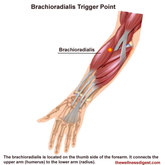 Brachioradialis Muscle Pain The Wellness Digest brachioradialis-muscle-pain-the-wellness-digest