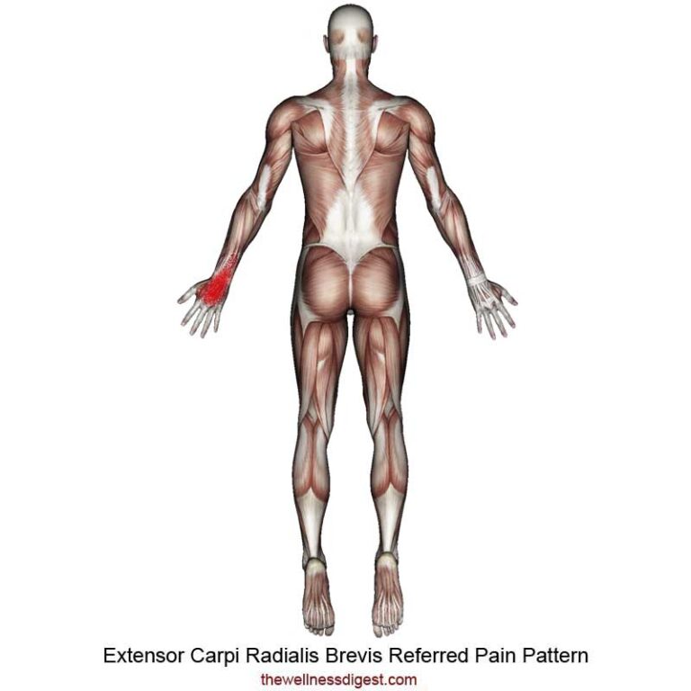 Extensor Carpi Radialis Brevis Muscle Pain – The Wellness Digest