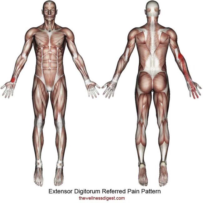 Extensor Digitorum Muscle Pain – The Wellness Digest