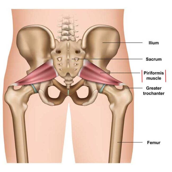 Piriformis Muscle Low Back, Hip, Buttock, Pelvic, Thigh Pain The
