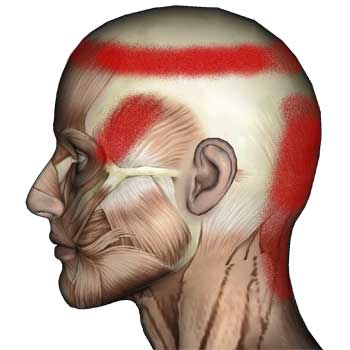 Read more about the article Semispinalis Capitis Muscle: Neck and Head Pain