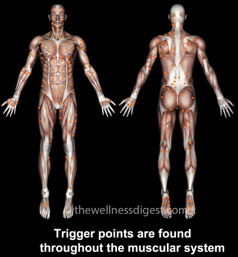 Illustration of muscle trigger points in the human body.