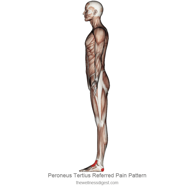 Image showing the pain pattern of the peroneus tertius muscle