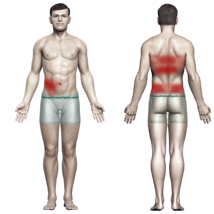 Rectus abdominis referred pain pattern diagramed on a human body.