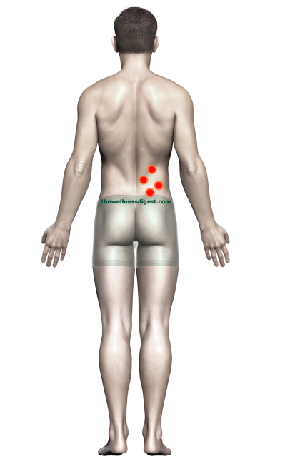 Trigger point diagram for QL