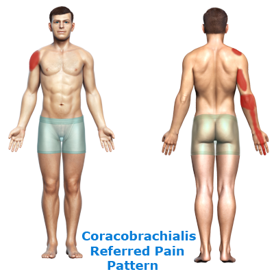 rtwd-coracobrachialis-400-link