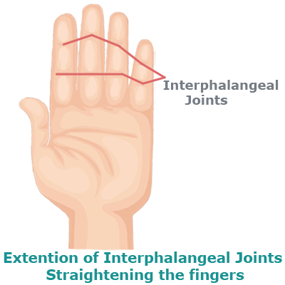 rtwd-extention-interphalangeal-joints rtwd-extention-interphalangeal-joints