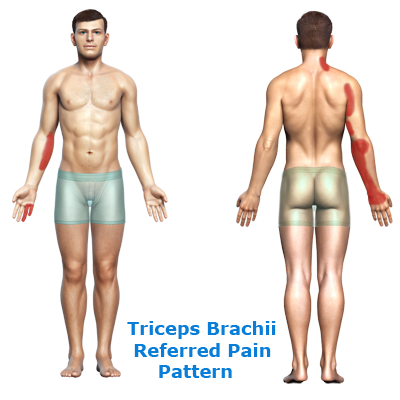 rtwd-triceps-brachii-pain-400-pain