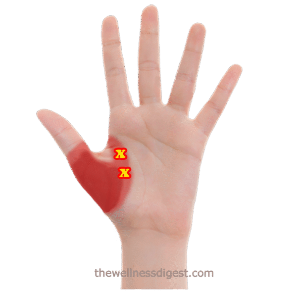 Adductor Pollicis Trigger Points Image showing the adductor pollicis trigger points