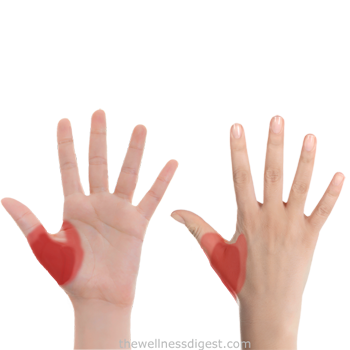ntwd-adductor-pollicis-pain-350