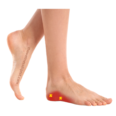 Trigger Point Locations of Abductor Digiti Minimi Foot Muscle Abductor digiti minimi foot muscle trigger point locations