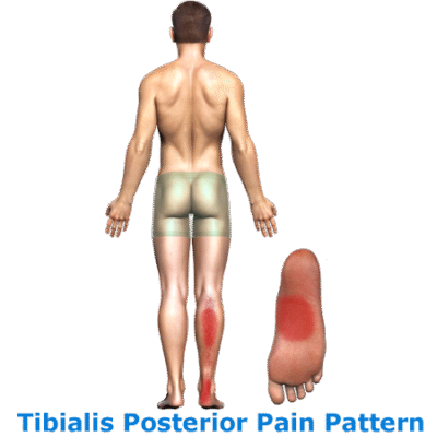 ntwd-tibialis-posterior-link