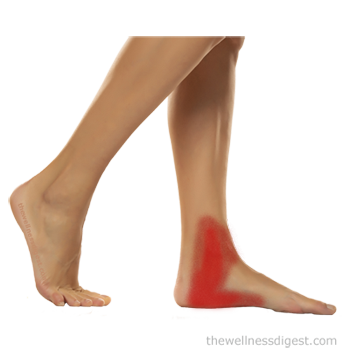 ntwd-abductor-hallucis-pain-350
