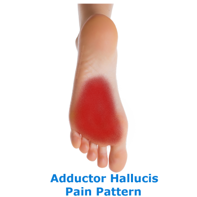 ntwd-adductor-hallucis-link