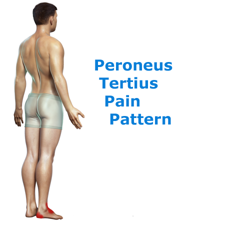 ntwd-peroneus-tertius-pain-link1