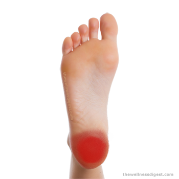 ntwd-quadratus-plantae-pain-350