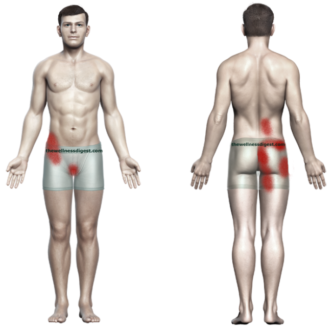 Is this your back pain? See how the QL muscle plays a role.