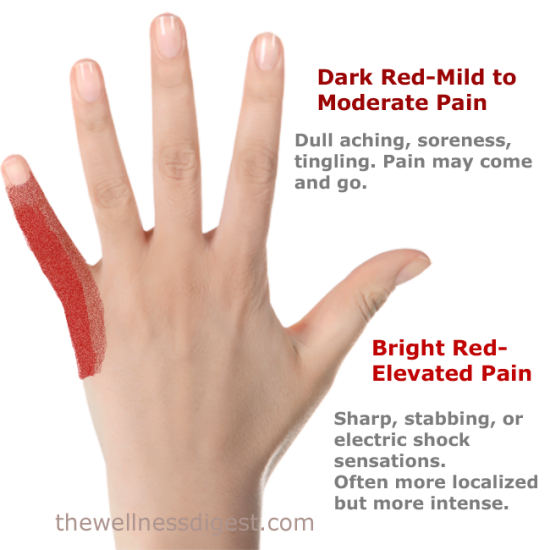 abductor-digiti-minimi-pain abductor-digiti-minimi-pain