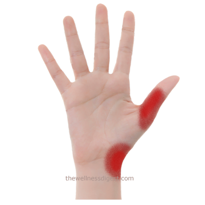 Opponens Pollicis Pain Featured Image.