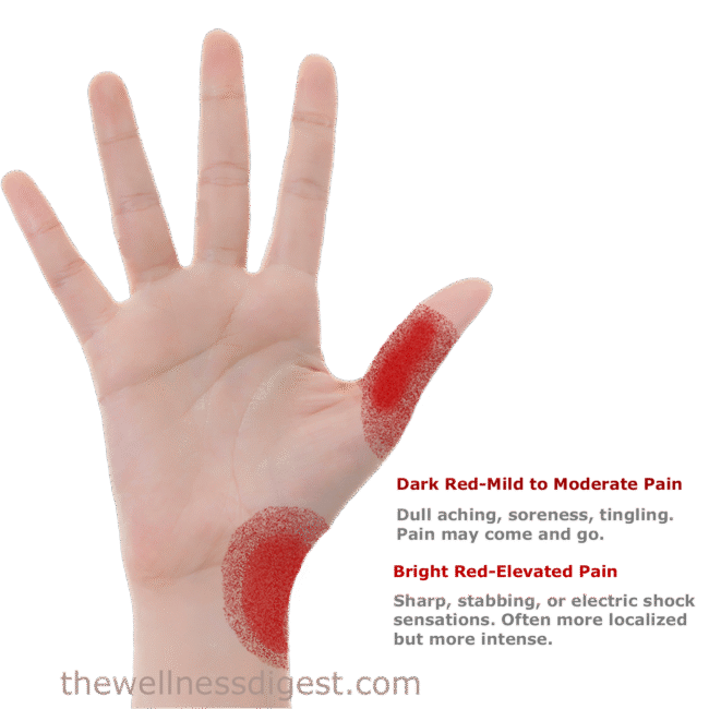 Opponens Pollicis Pain Opponens Pollicis Referred Pain Pattern