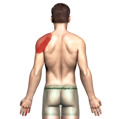 Teres Minor Pain