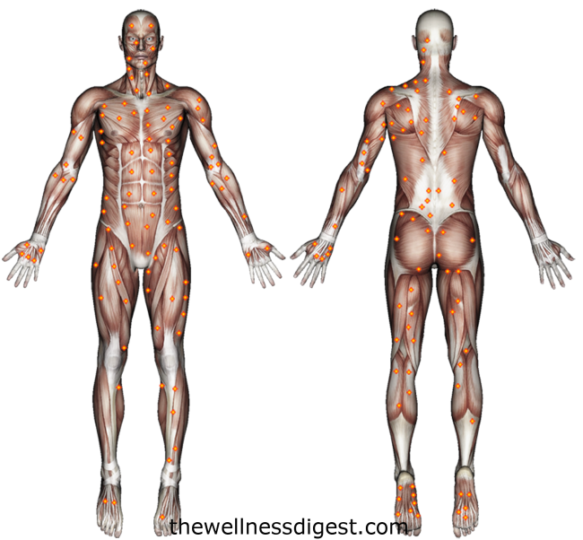 Trigger Points